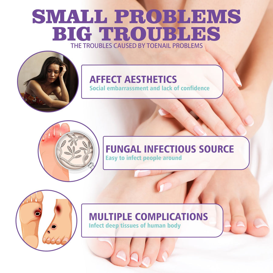 Nail Fungus Spray for Soothing Cooling Daily Nail Care