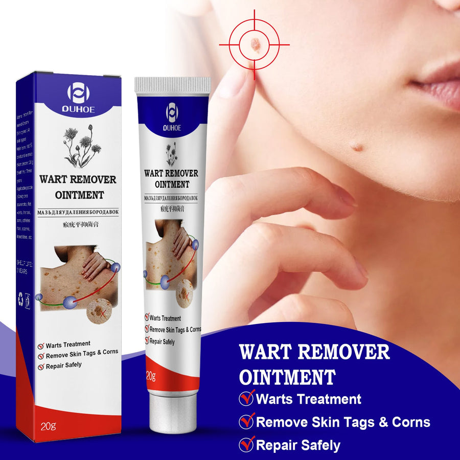 Wart Remover Ointment — Safe Removal of Warts, Skin Tags