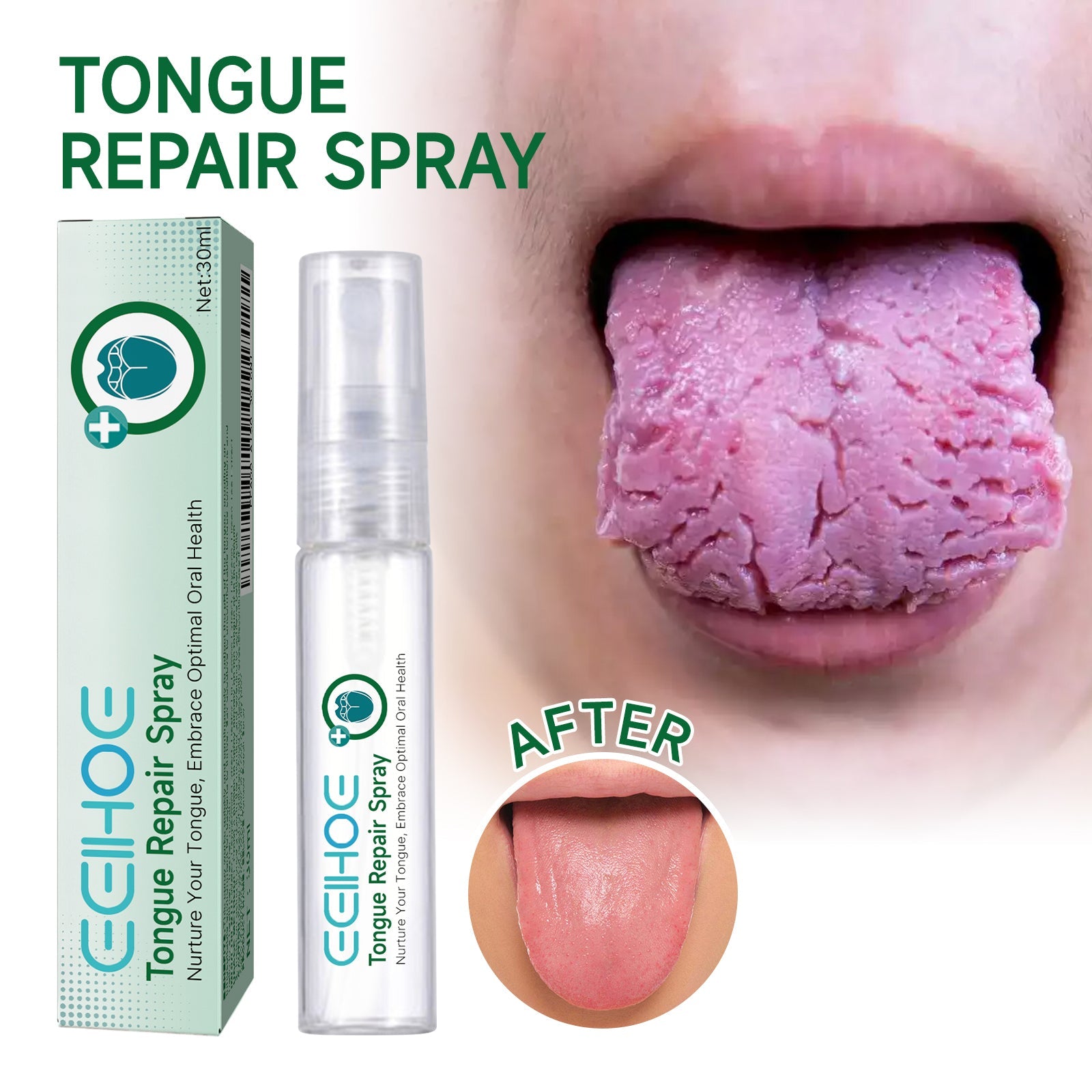 Educational chart showing six tongue health conditions: glossitis, xerostomia, white tongue, swollen tongue, painful & sore tongue, and bacterial accumulation (bad breath)