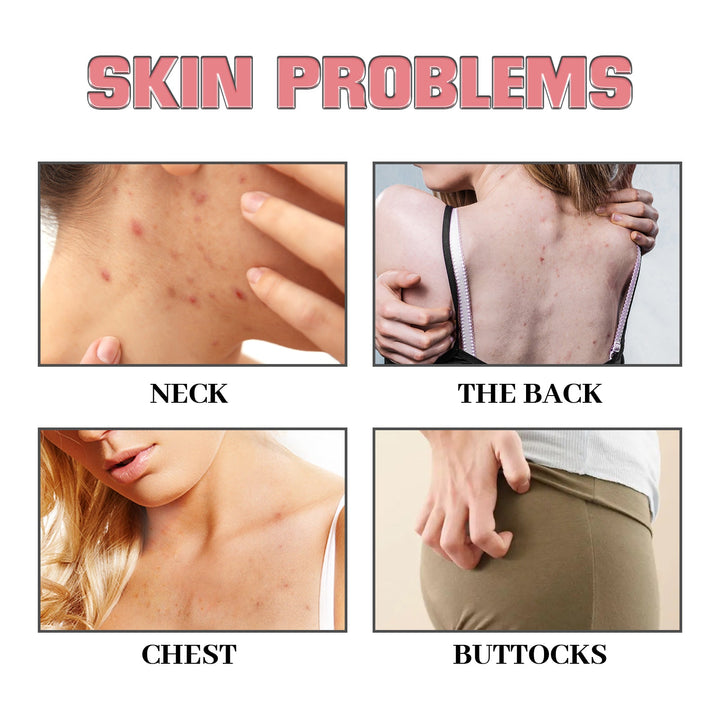 Exfoliating Body Soap for Acne-Prone, Smoother Skin
