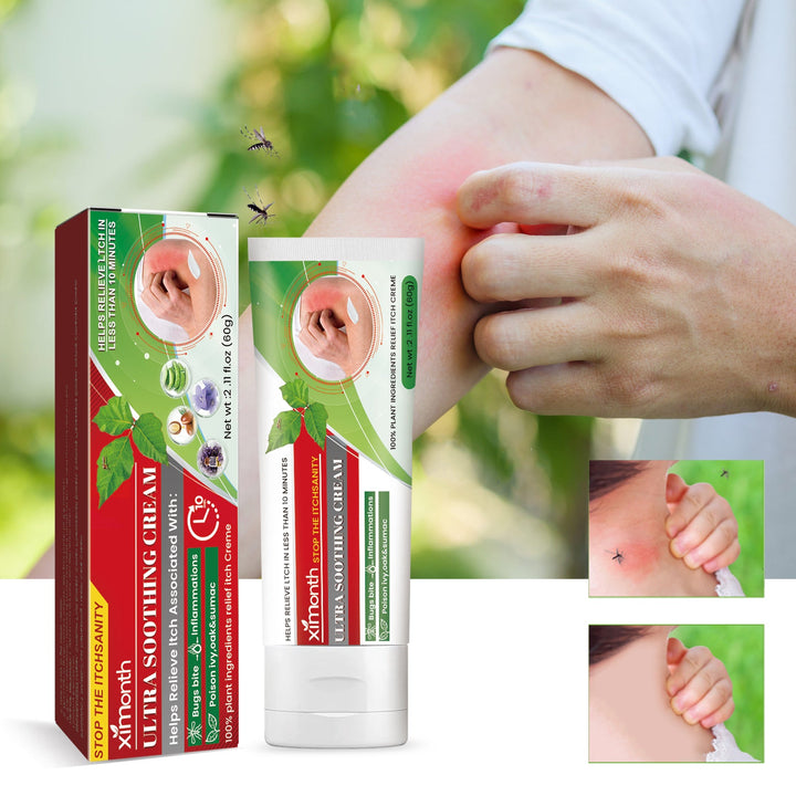 Ultra Soothing Cream for Bug Bites & Itchy Rash Relief