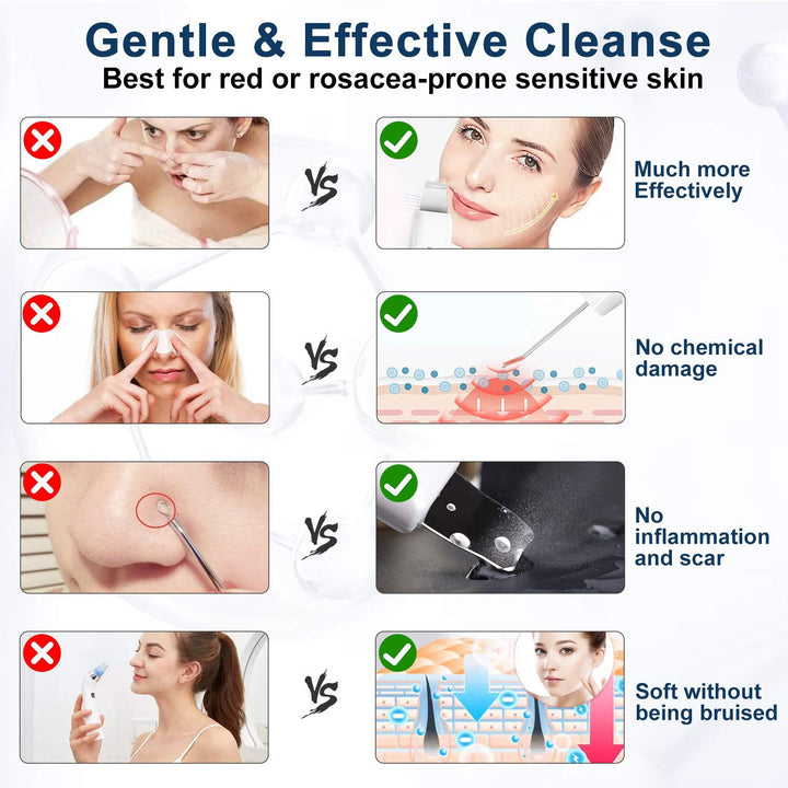 Ultrasonic Facial Cleanser — Deep Pore Cleansing