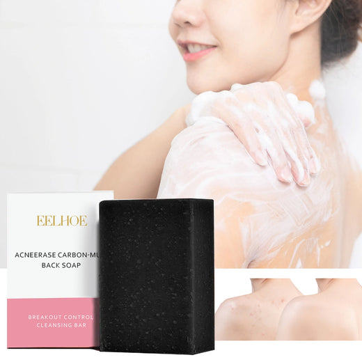 Carbon Clay Back Soap for Body Acne & Dark Spots