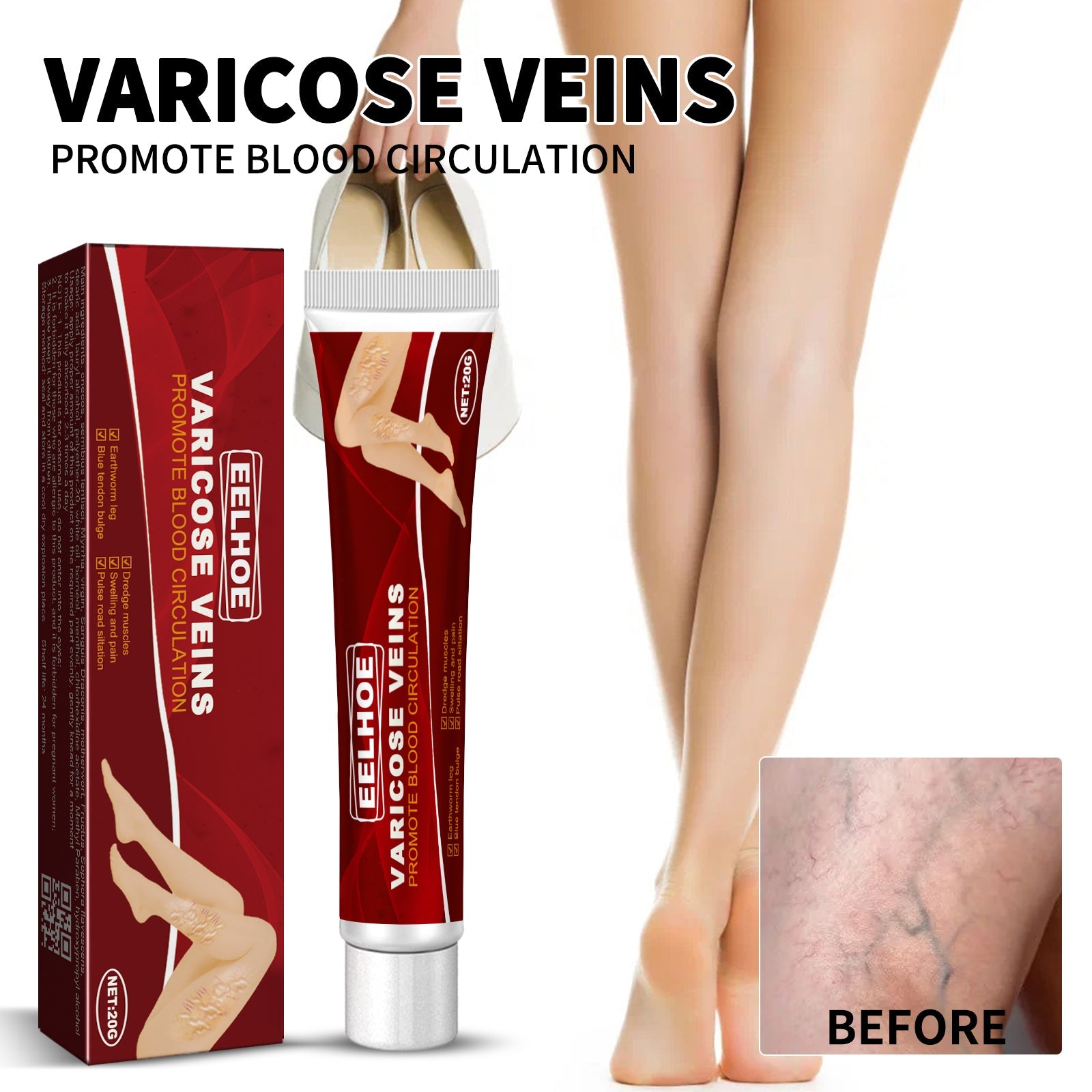 Symptom severity chart showing mild, moderate, and severe varicose vein examples with usage cycle recommendations