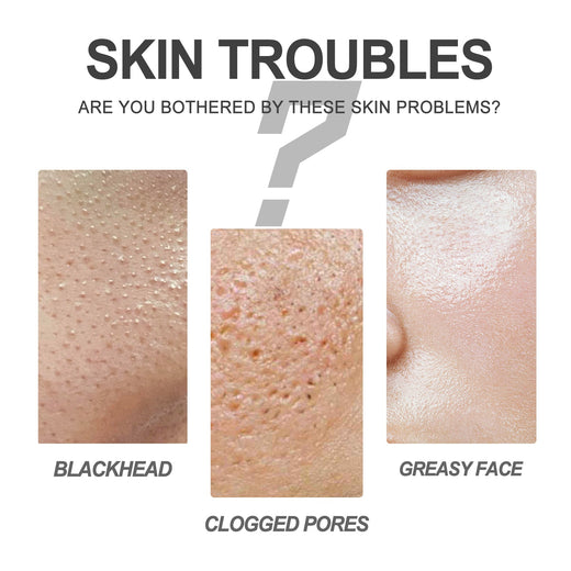 Two-Step Pore Cleansing Kit for Blackheads & Pores