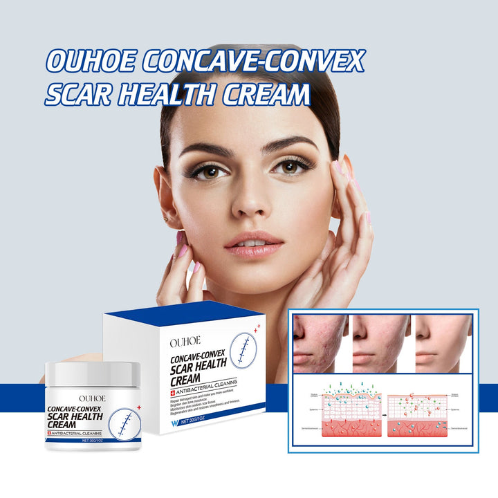 Ouhoe Scar Repair Cream, Gentle Repair Smooth Skin Fade Afte