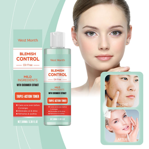 Cucumber Toner That Calms Acne Before It Starts