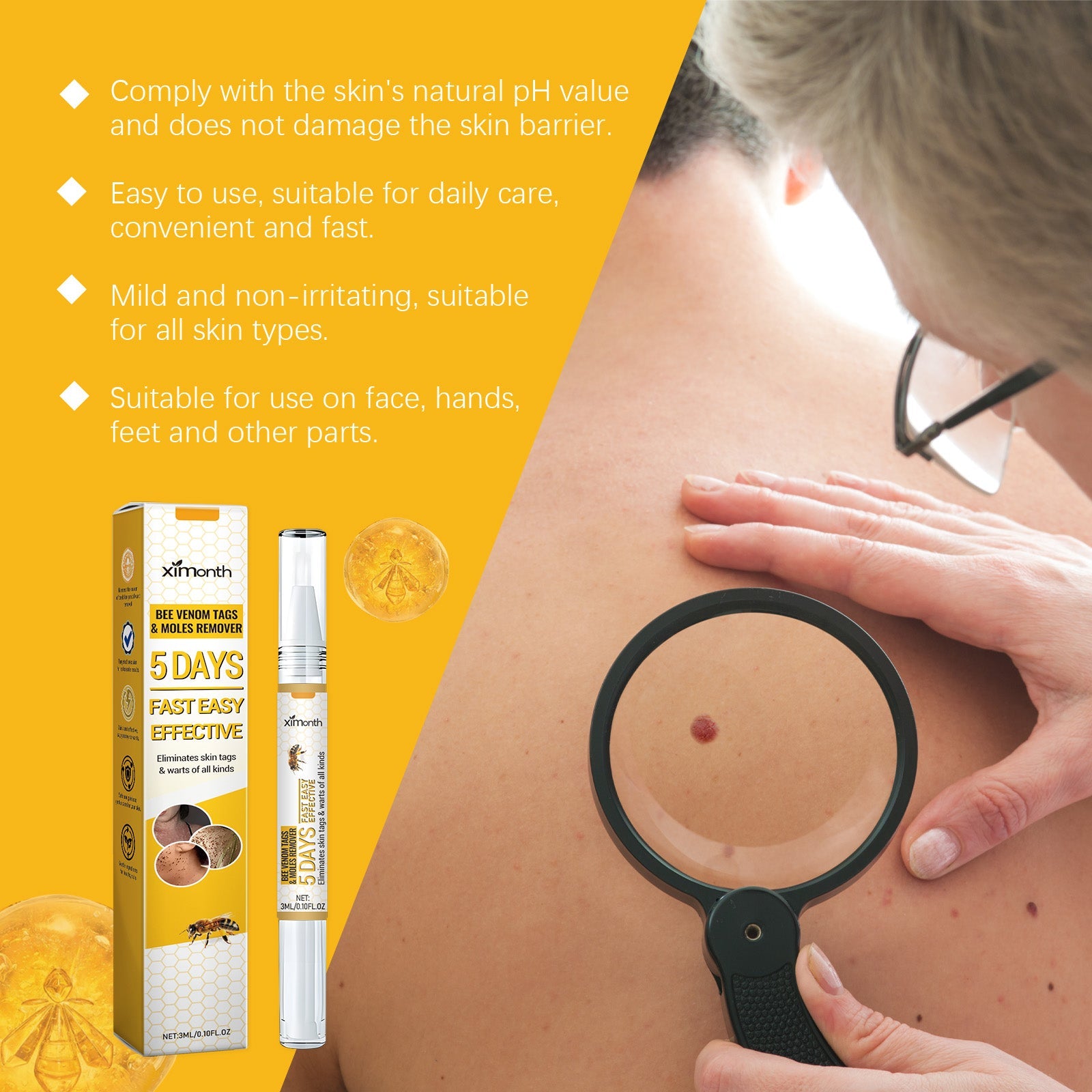 Close-up skin application with magnified before/after circles showing skin tag removal results on actual skin with visible improvement
