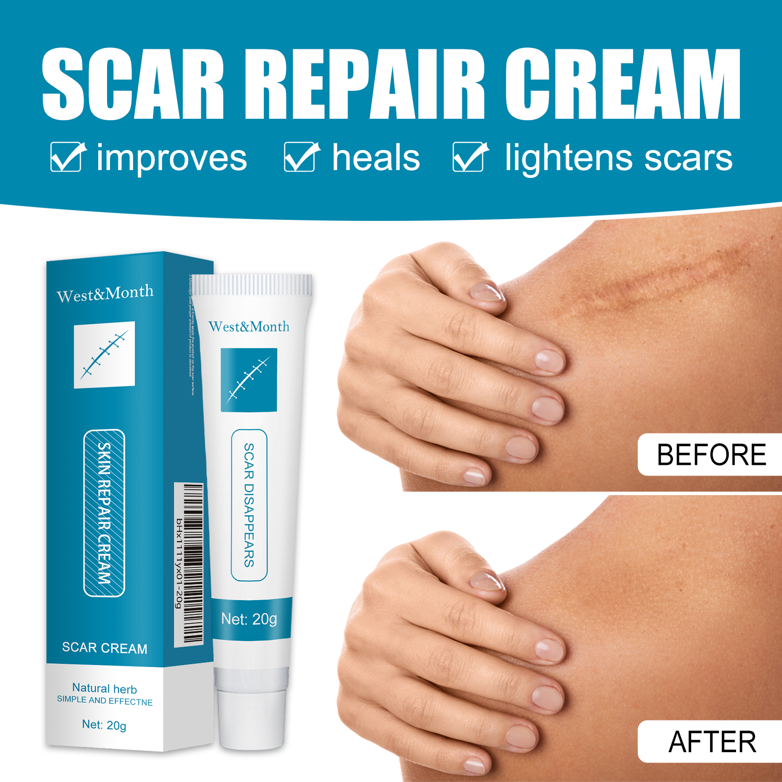 Infographic showing three-step mechanism: inhibit proliferation, repair and desalination, activate regeneration with cross-section skin diagrams
