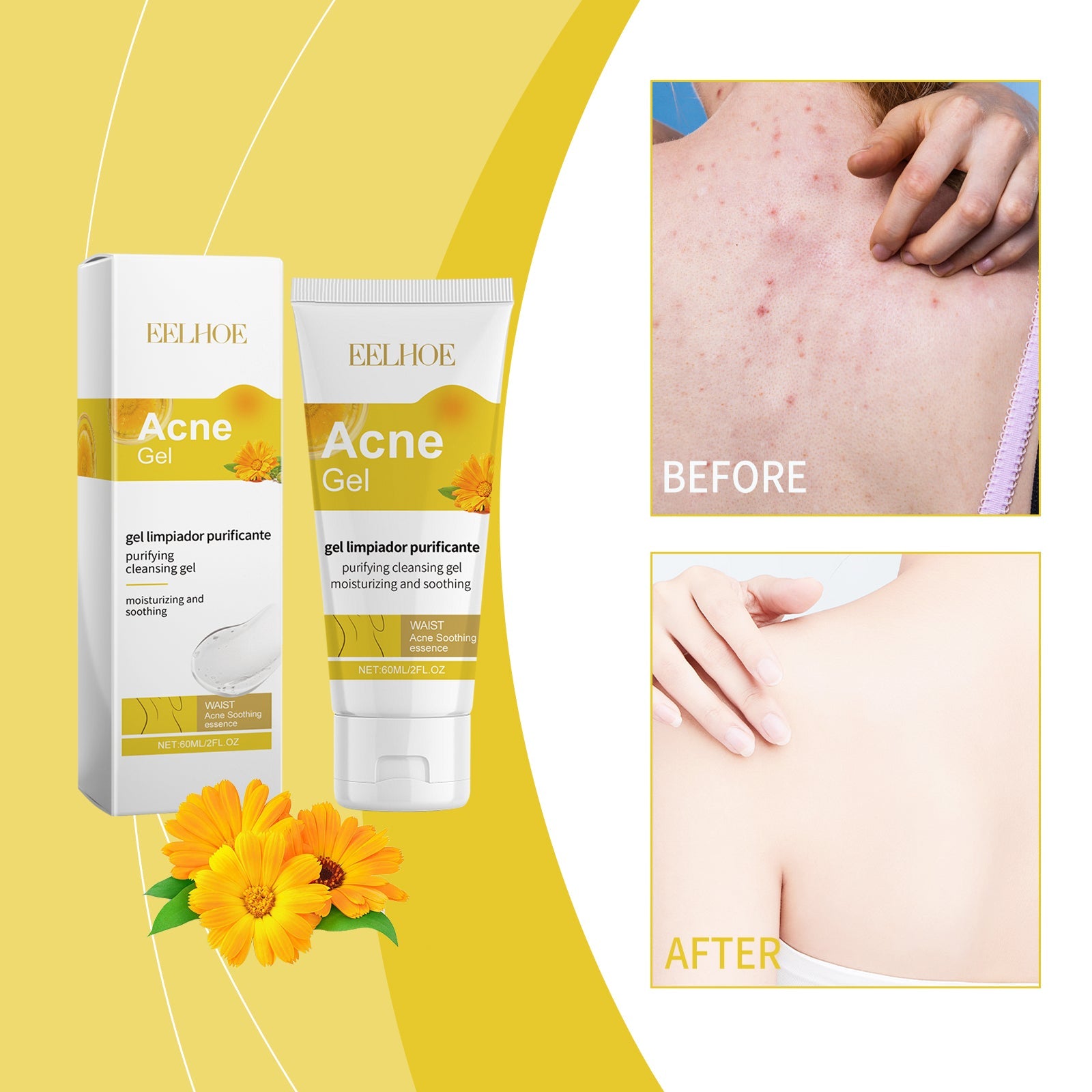 Lifestyle image showing soothing botanical ingredients including aloe vera extract, calendula, and golden oil droplets alongside woman in yellow