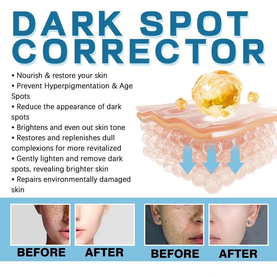 Dark Spot Corrector Cream for Brighter Even Skin Tone