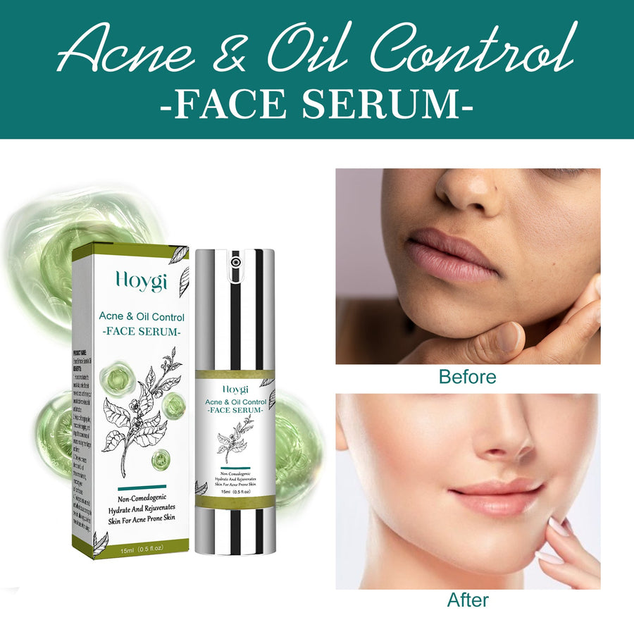 Tea Tree Face Serum for Acne-Prone, Oily Skin Hydration