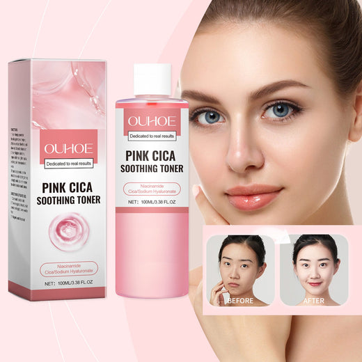 Cica Repair Toner for Redness and Uneven Skin Tone