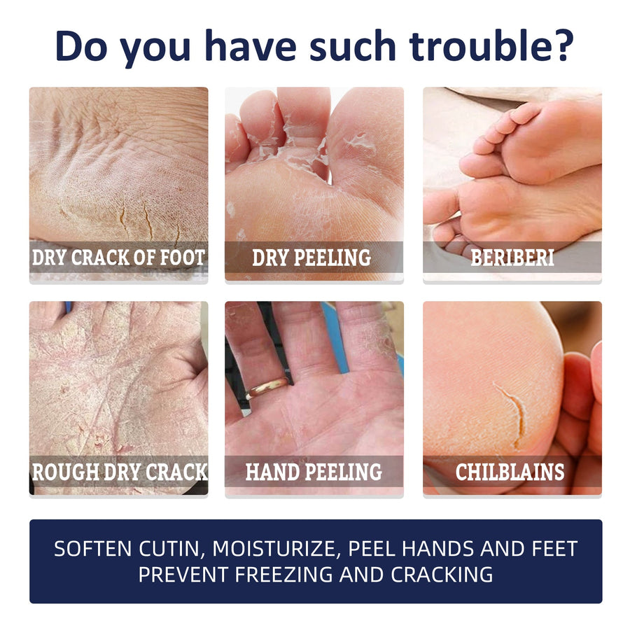 Hand & Foot Repair Cream for Cracked, Rough Skin 30g