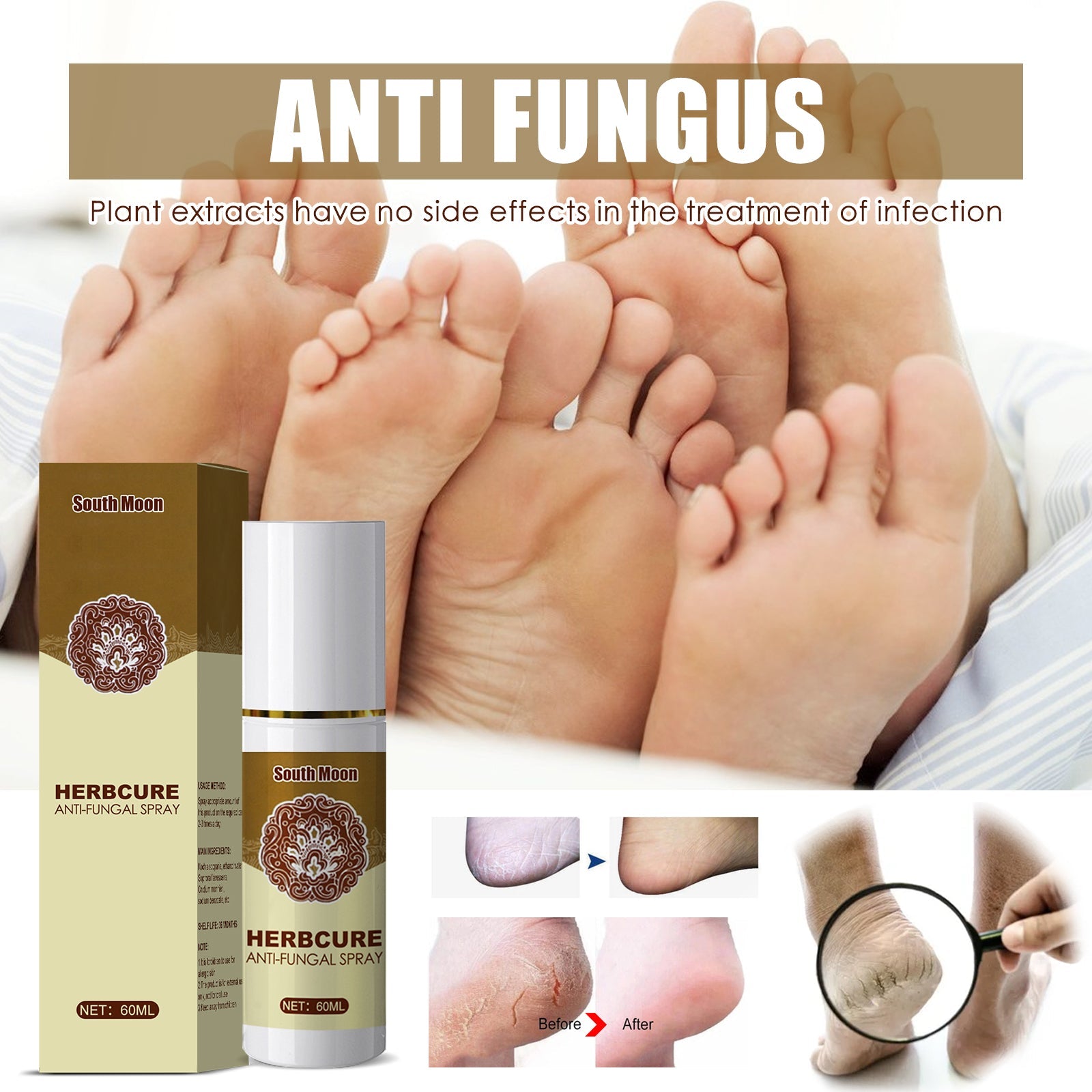 Text listing key benefits: moisturizes, softens dead skin, leaves silky smooth; feature box highlights 'For Extremely Dry, Cracked Rough Skin'; six detailed problem condition images (dead skin, peeling, cracking, nail ringworm, beriberi)
