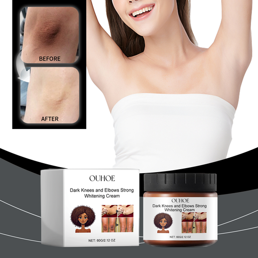 Dark Knee & Elbow Cream for Even, Bright Skin Tone