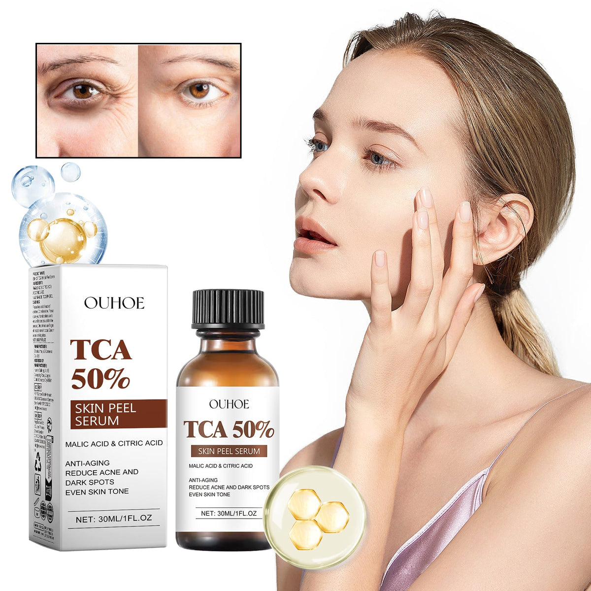 TCA 50 Skin Peel Serum for Wrinkles and Dark Spots
