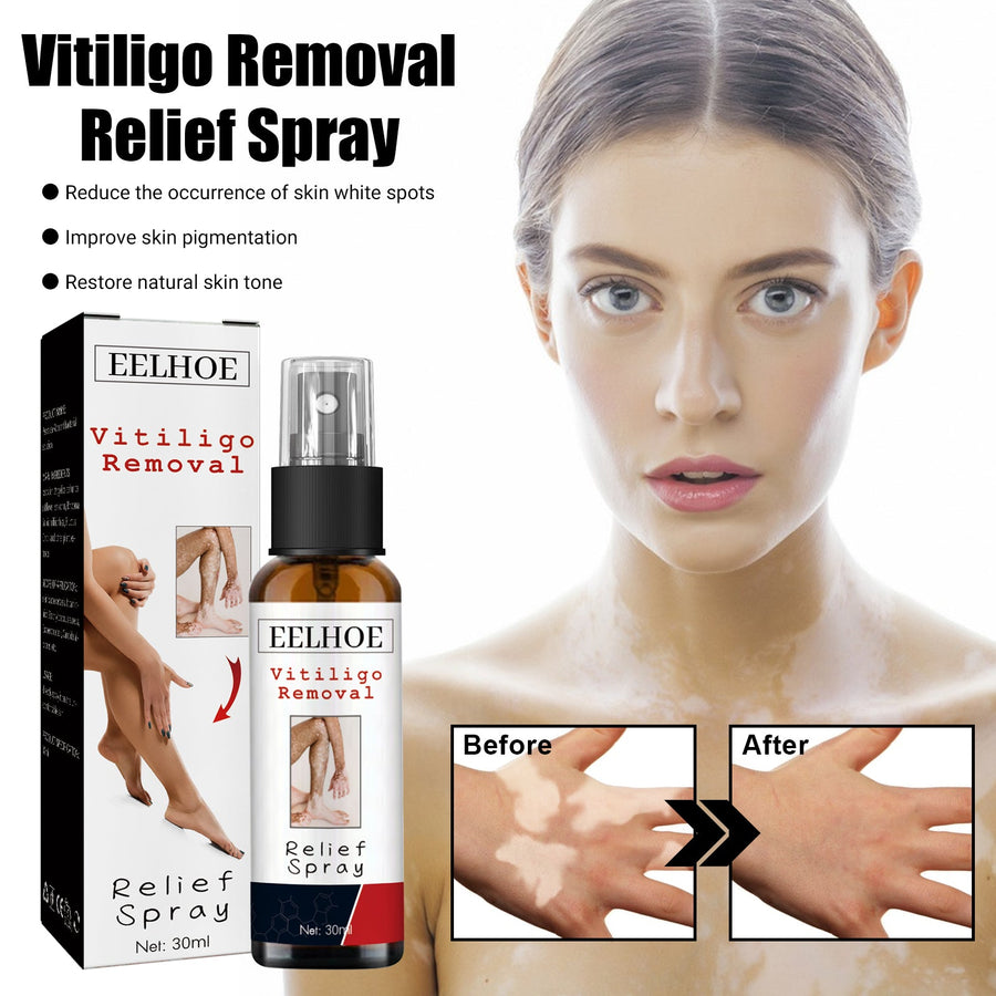 Vitiligo Relief Spray — Restore Natural Skin Tone