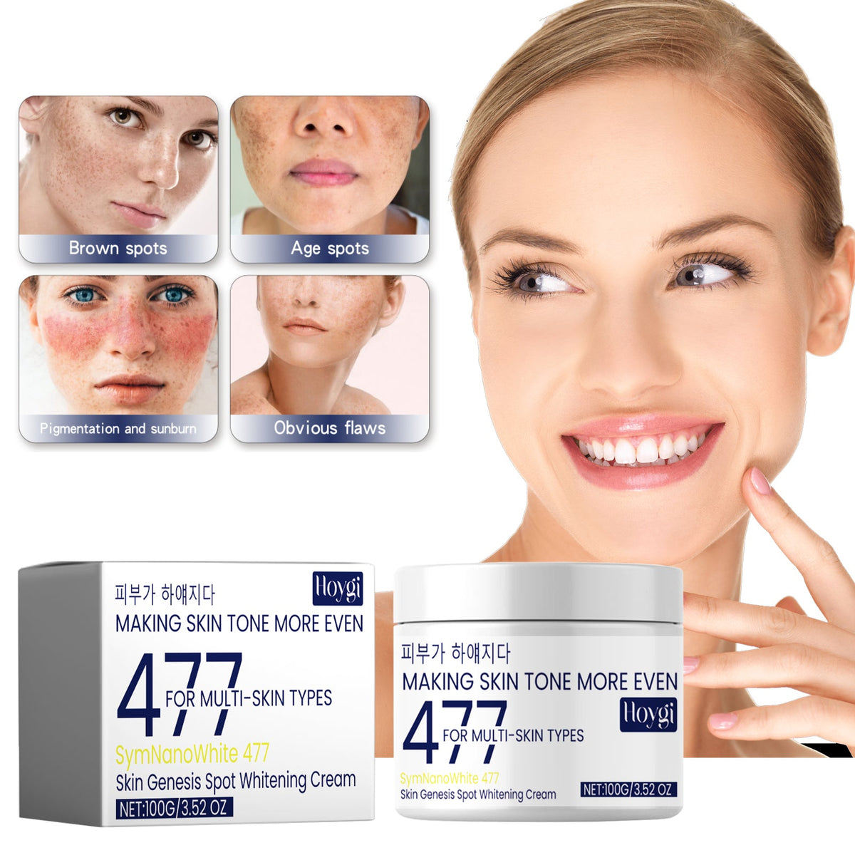 Skin Genesis Spot Cream: Even Tone, Fade Dark Spots