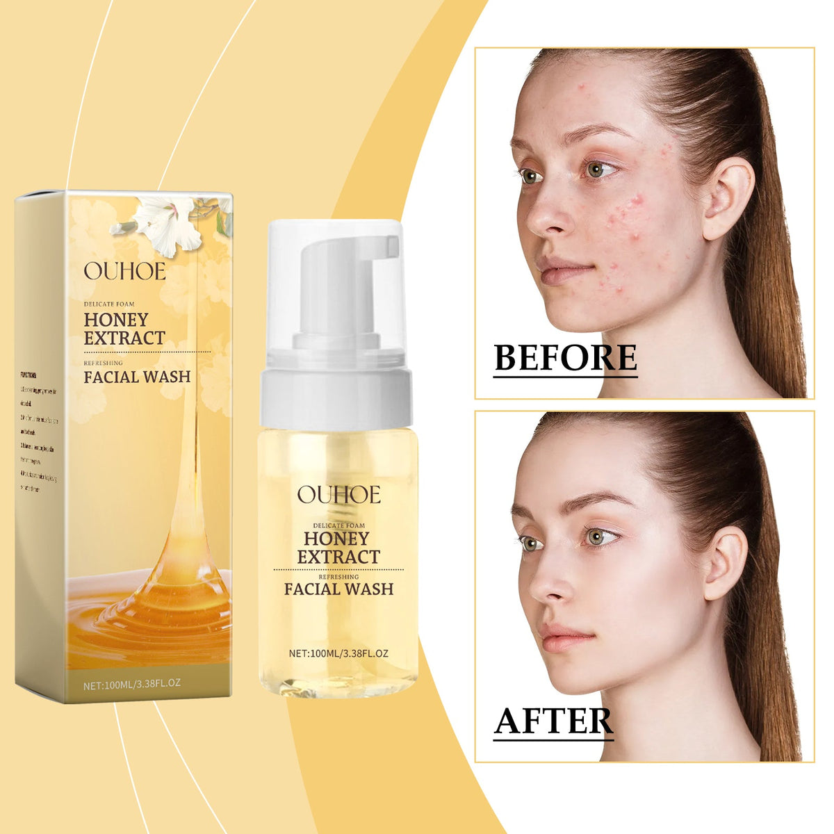 Honey Foam Cleanser for Acne-Prone Oily Skin
