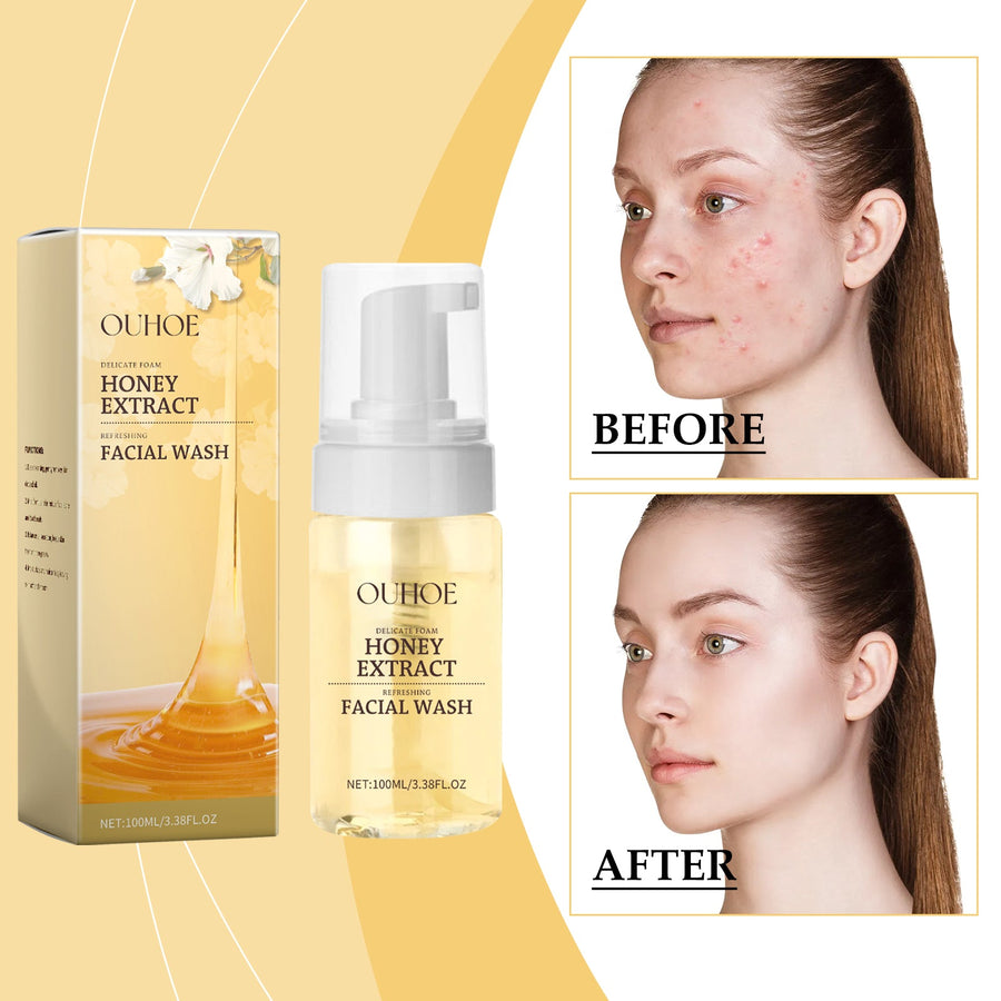 Honey Foam Cleanser for Acne-Prone Oily Skin