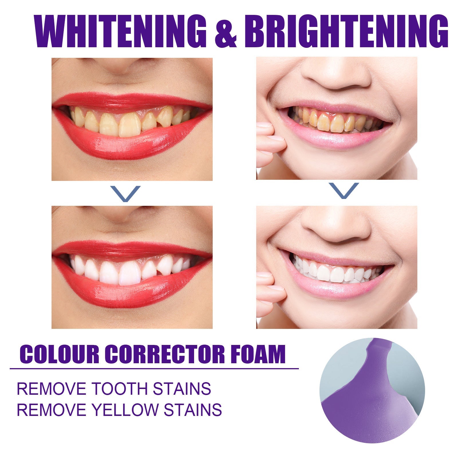 Four-image grid showing teeth whitening and brightening transformation for two different users with yellow/stained teeth becoming bright white