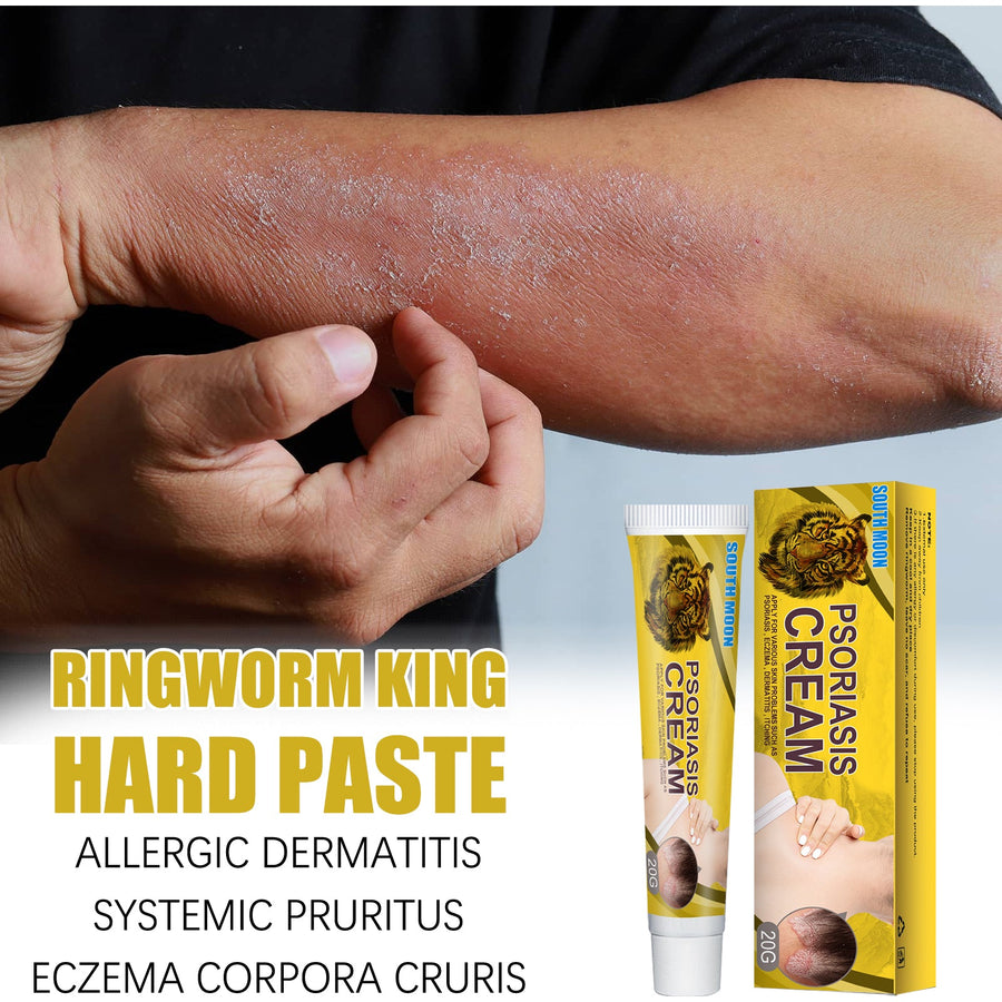 Ringworm Treatment Cream — Visible Skin Repair in Days