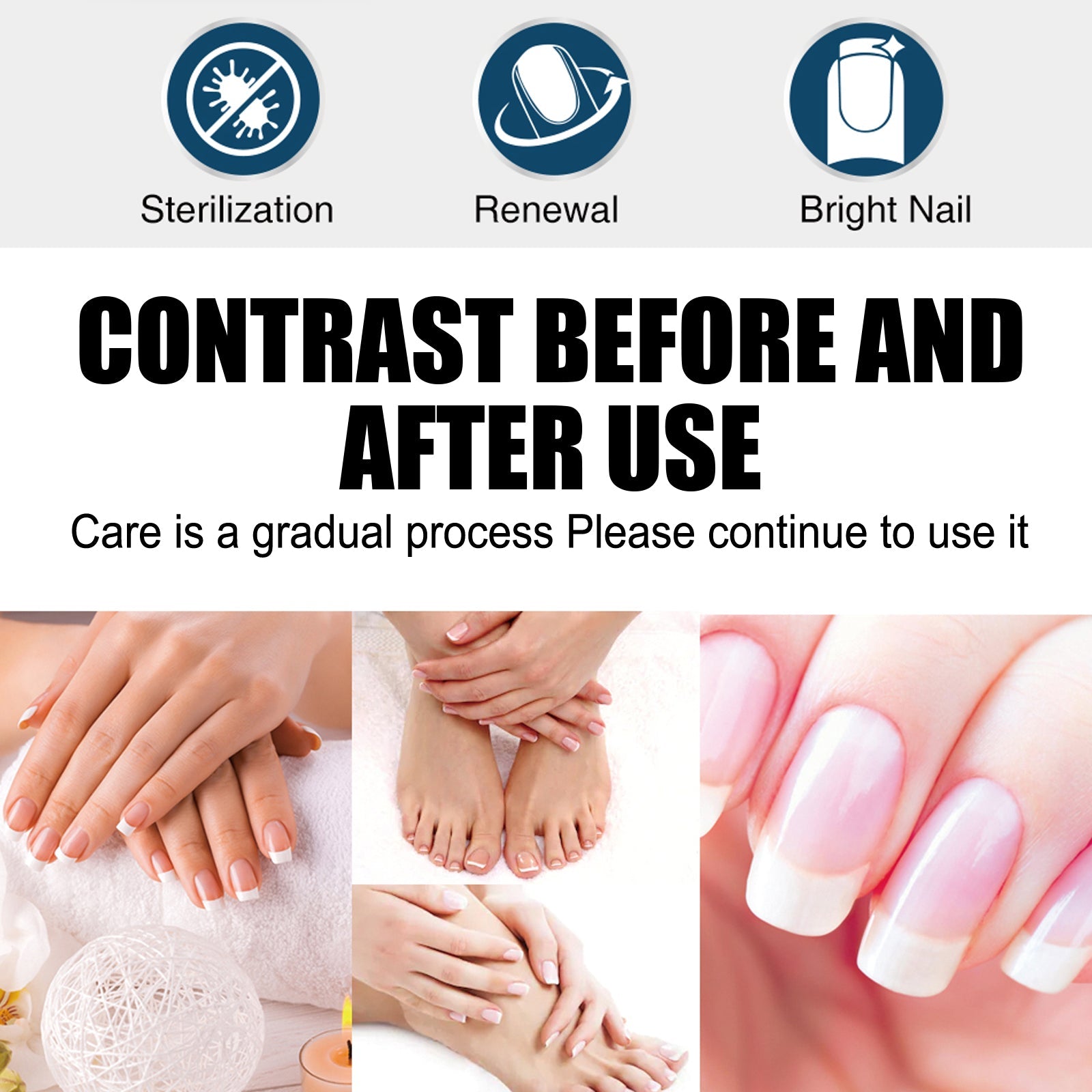 Three benefit icons (Sterilization, Renewal, Bright Nail) with before-and-after nail comparisons showing multiple nail conditions