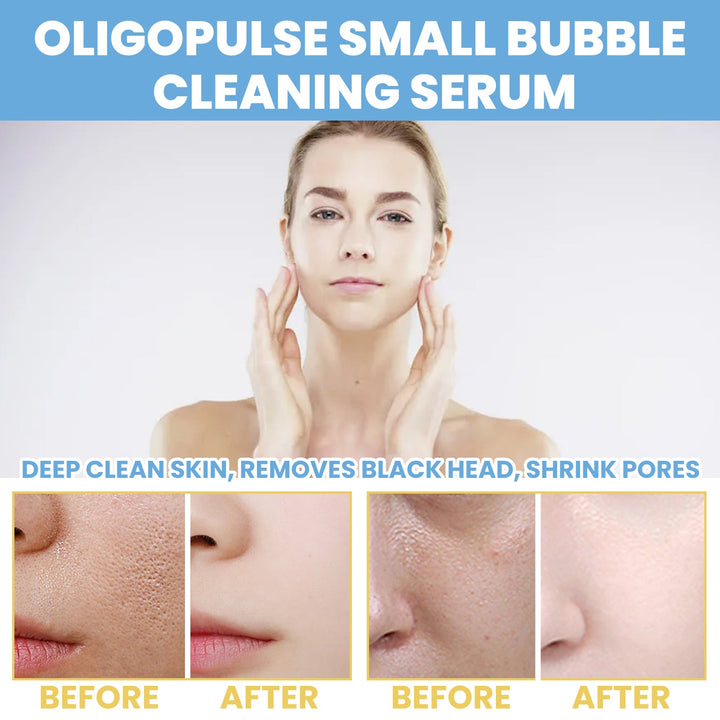 Oligopeptide Bubble Cleansing Essence for Pore Tightening