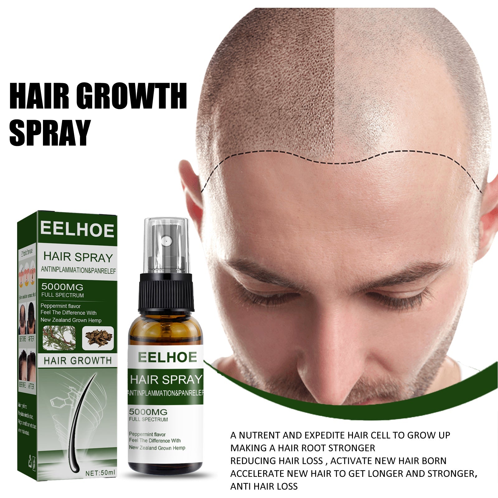 Grid of six different hair loss conditions: postpartum alopecia, perm dyeing hair loss, seborrheic alopecia, balding, hairline height recession, and alopecia areata - each photographed showing severity
