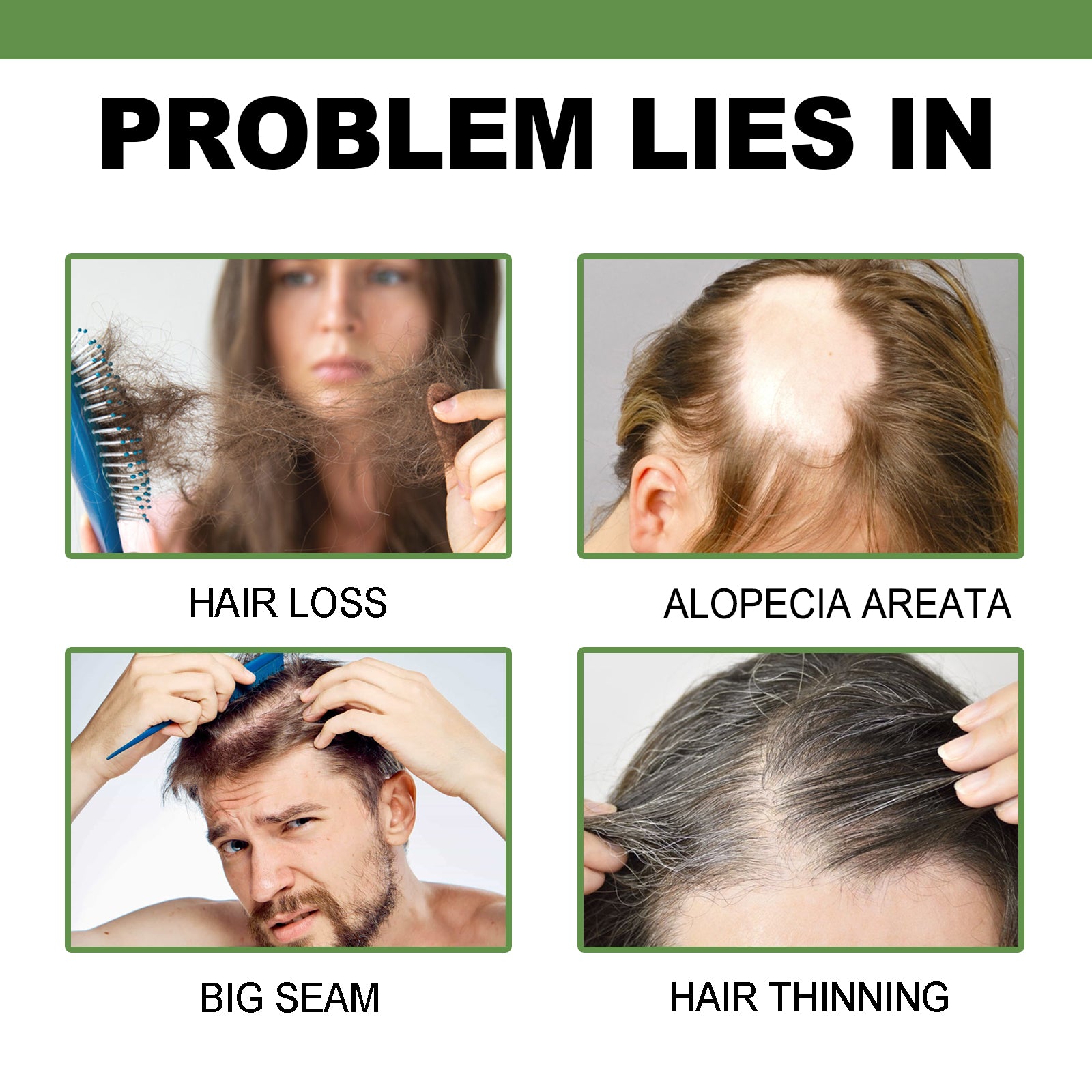 Male head showing visible hair loss on crown split-screen before and after using product