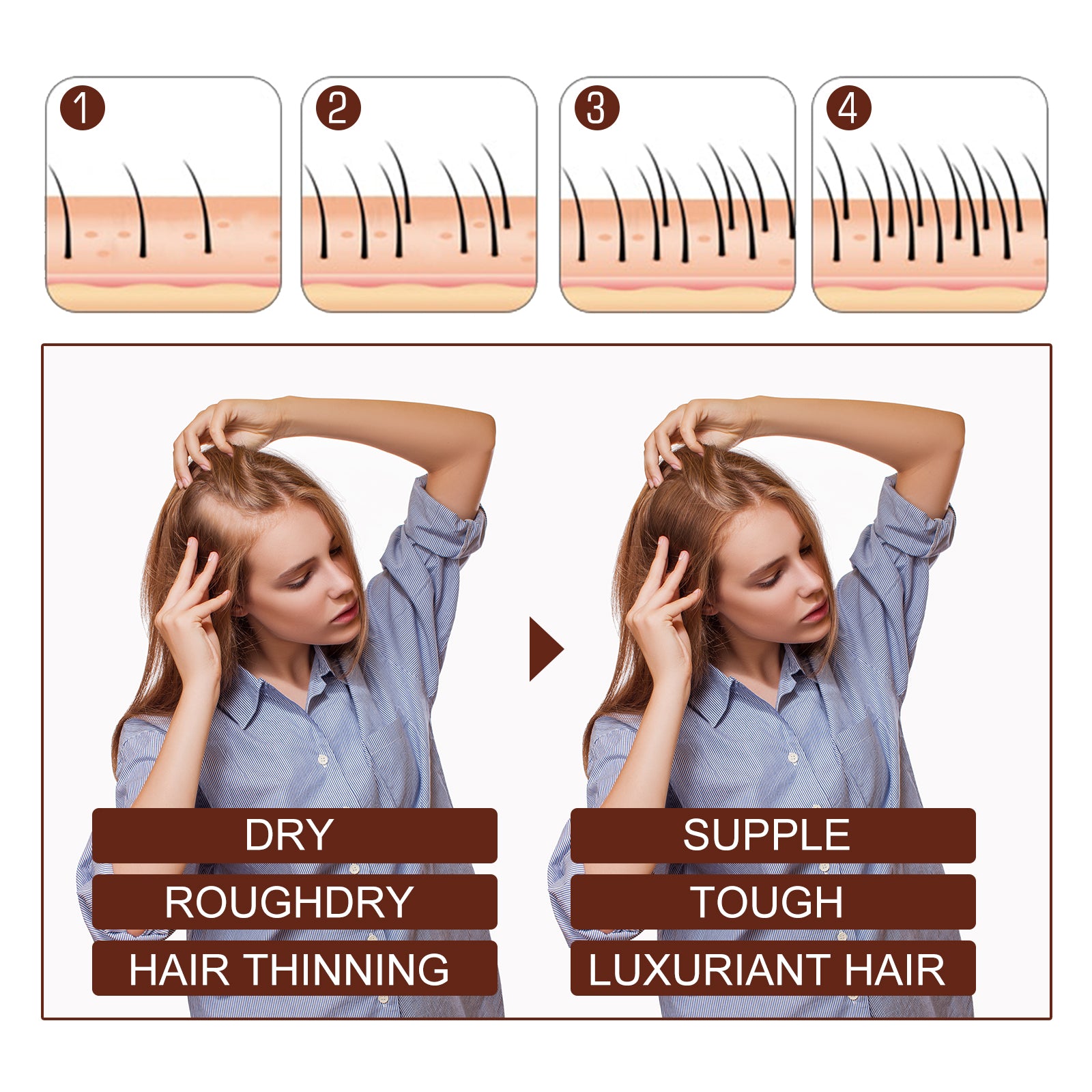 Six scenarios of common hair loss types: postpartum alopecia, perm dyeing loss, seborrheic alopecia, balding, hairline receding, and alopecia areata
