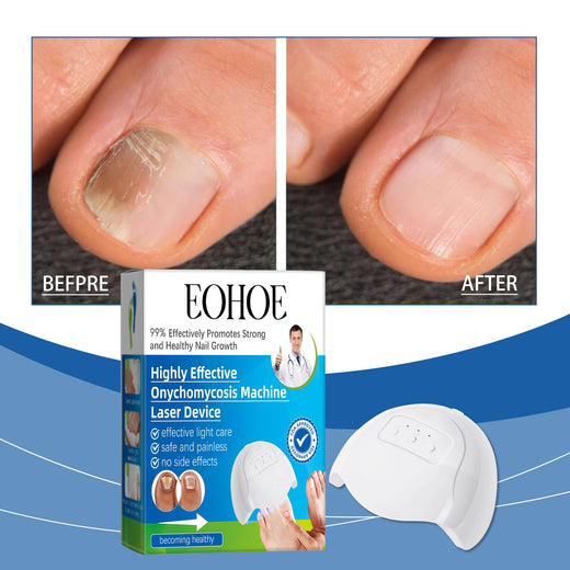 Nail Care Device for Stronger, Healthier-Looking Nails