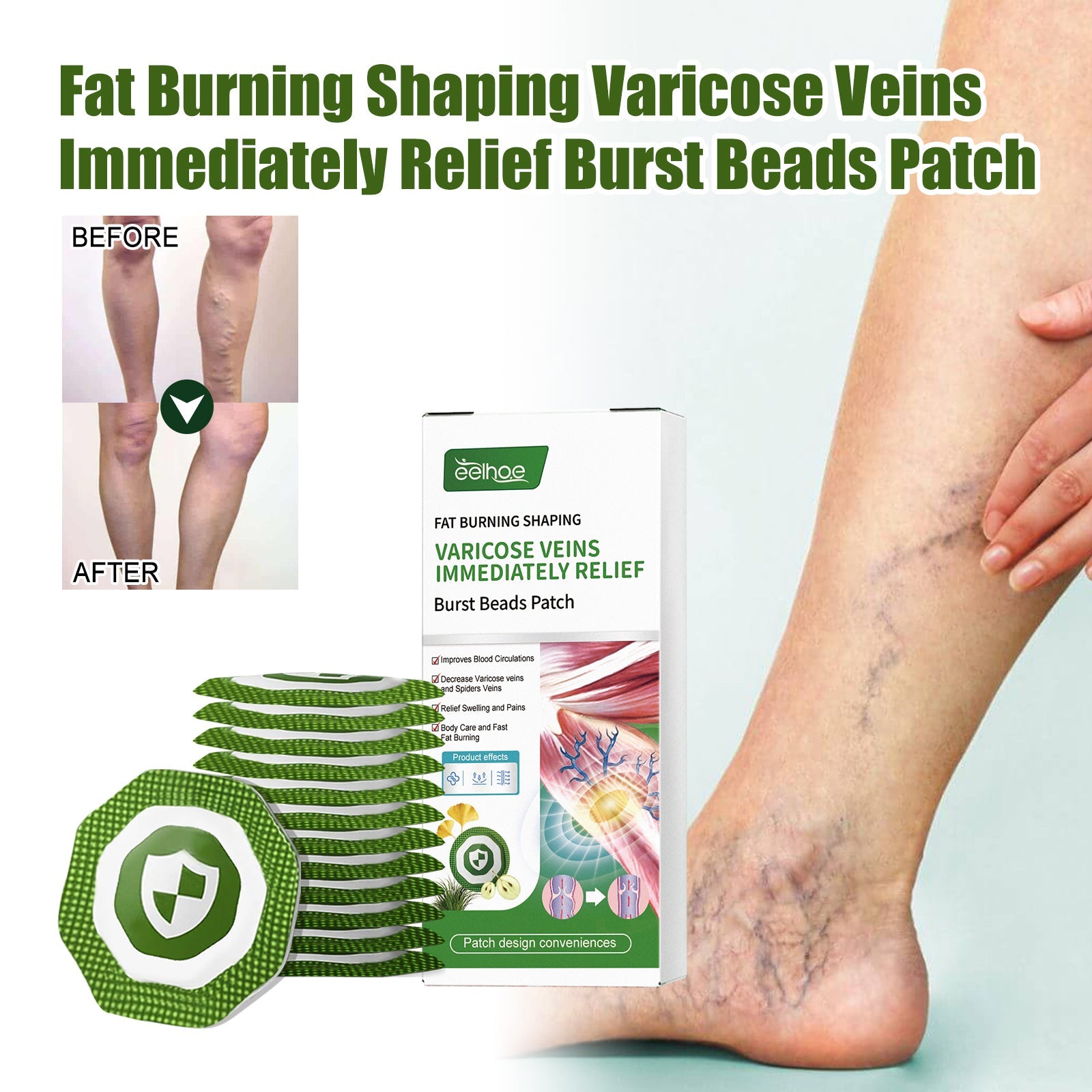 Four pain-point scenarios: obvious bloodshot, earthworm leg, thick legs, swelling and soreness with clinical descriptions