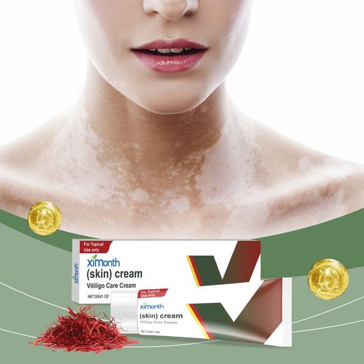 Gentle Body Cream for Sensitive Skin & Uneven Tone