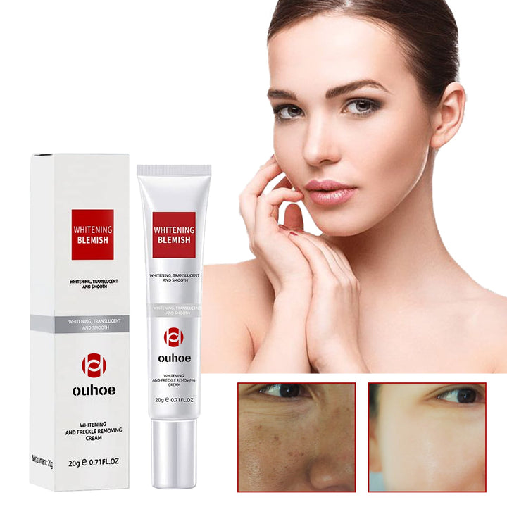 Dark Spot Corrector Cream for Fading Age Spots & Freckles