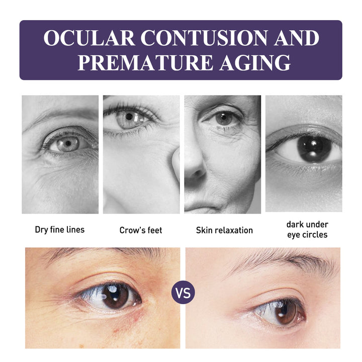 Anti-Wrinkle Eye Cream — 60-Second Tightening Gel