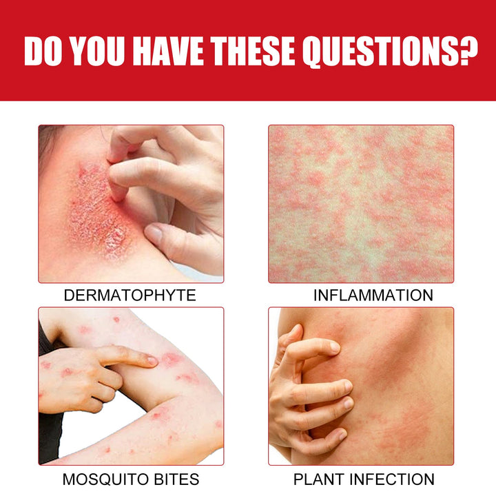 Ultra Soothing Cream for Bug Bites & Itchy Rash Relief