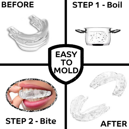Mouth Guard for Snoring & Nighttime Teeth Grinding