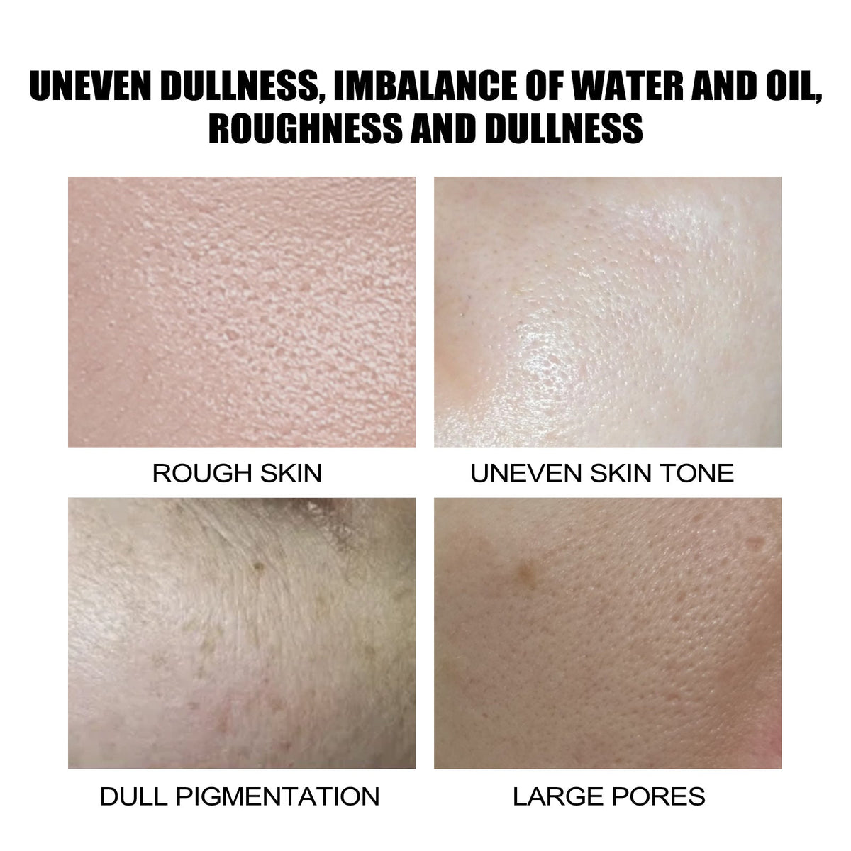 Lactobionic Acid Essence for Dull, Uneven Skin Tone