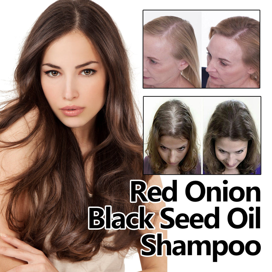 Red Onion Hair Oil for Smoother, Shinier-Looking Hair
