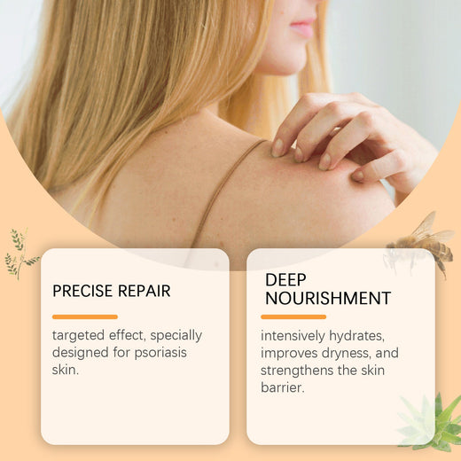 Herbal Repair Cream for Psoriasis & Eczema Relief