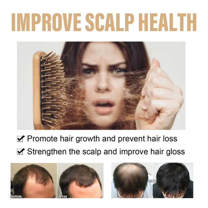 Onion Biotin Shampoo for Scalp Care, Strength & Gloss