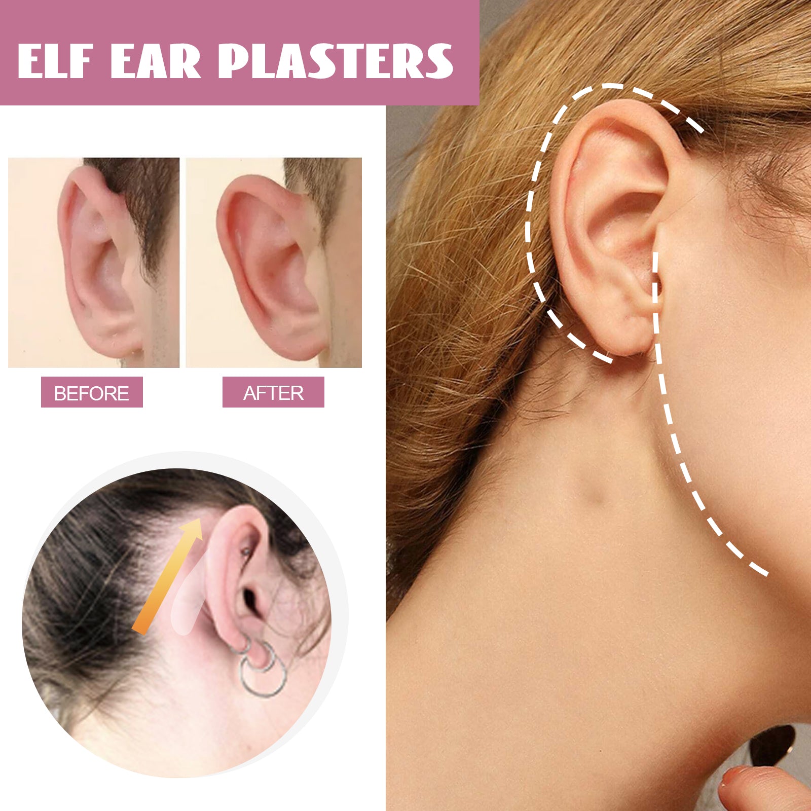 Multiple before/after comparison images of ears showing corrective reshaping, application detail with color-coded guides, and full-profile ear correction outline demonstration