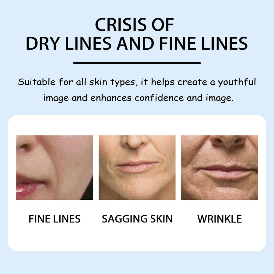 Nasolabial Fold Patches for Smoother Smile Lines Fast