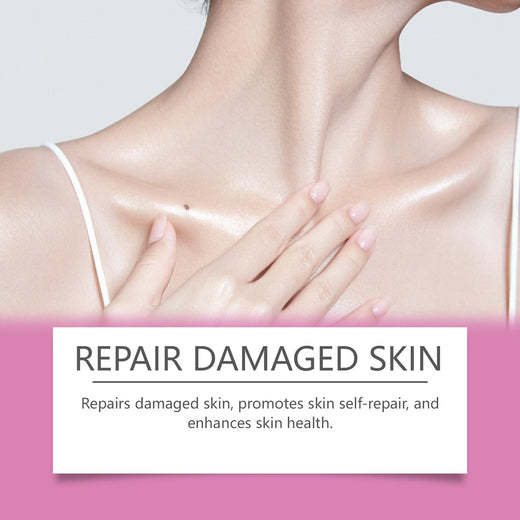 Extra Strong Peeling Oil — Fades Stretch Marks & Scars