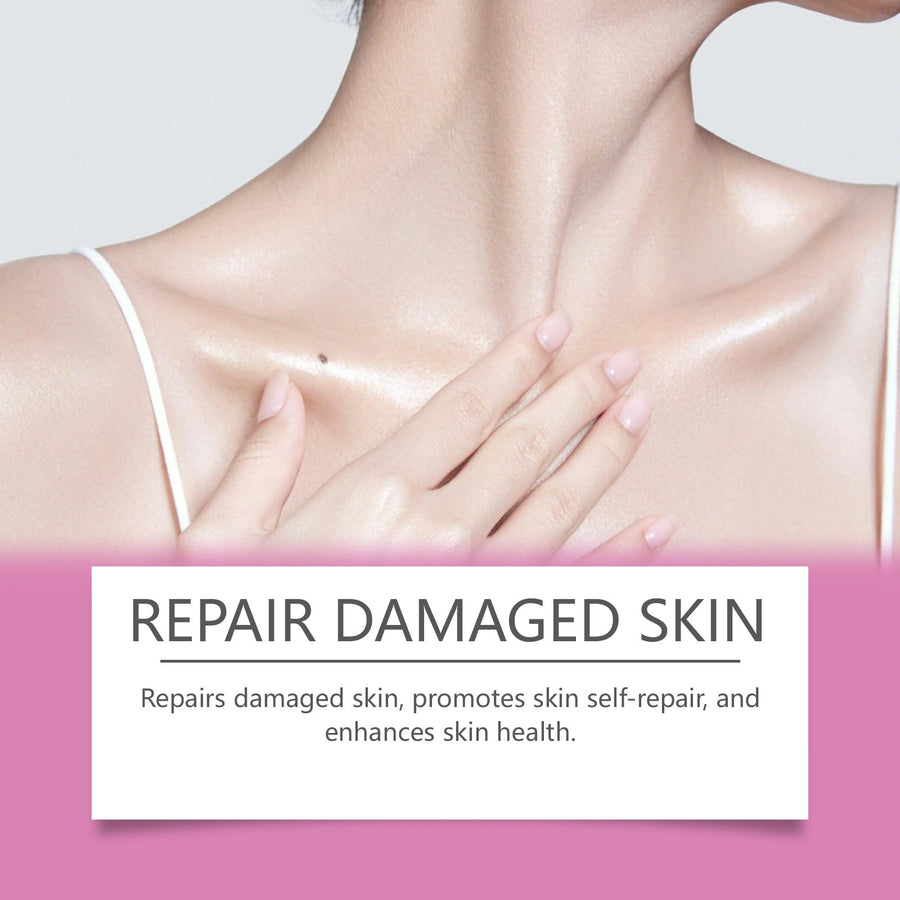 Extra Strong Peeling Oil — Fades Stretch Marks & Scars
