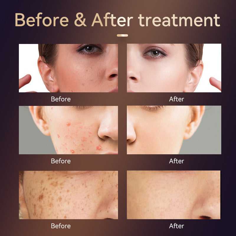 Photon Skincare Device for Brighter, Firmer-Looking Skin