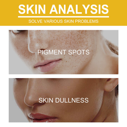 V7 Vitamin Cream for Wrinkles, Fine Lines & Dull Skin