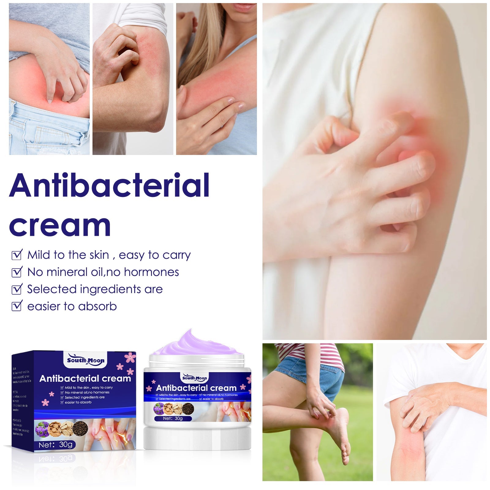 Composite showing packaging and product, followed by before/after close-up comparison of skin on inner arm—left image shows red, irritated patch; right image shows same area significantly calmed and evening out in tone